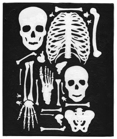 Detected Dictionary (Skelette 2)